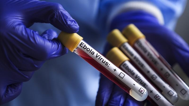 Ebolaya qarş ilk eksperimental peyvənd sınaqdan keçirilib&nbsp;