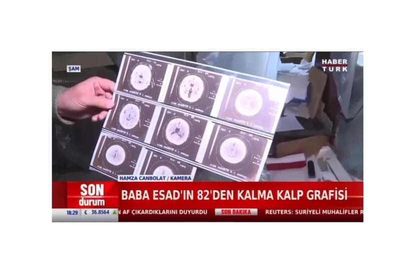 Bəşər Əsədin evindən bu KRALIN xəstəxana kağızları çıxdı - Video