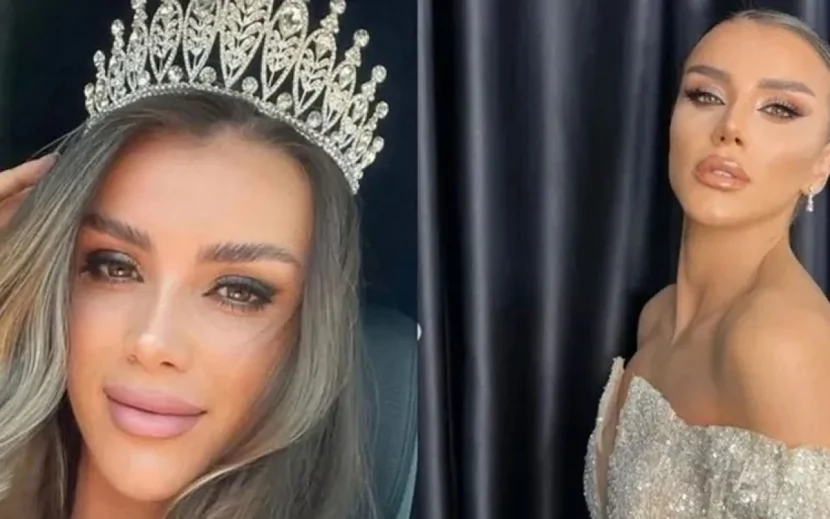 Körpüdən yıxılan modelin üstündən maşın keçdi