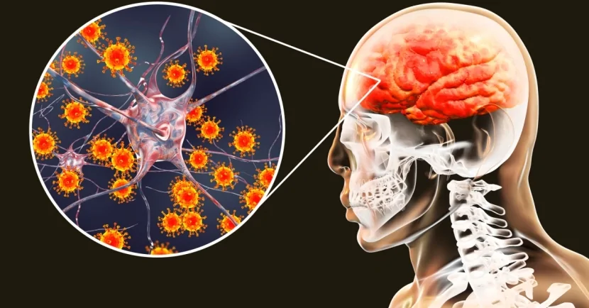 Meningit epidemiyası YAYILDI: 156 ÖLÜ VAR - BU ÖLKƏDƏ