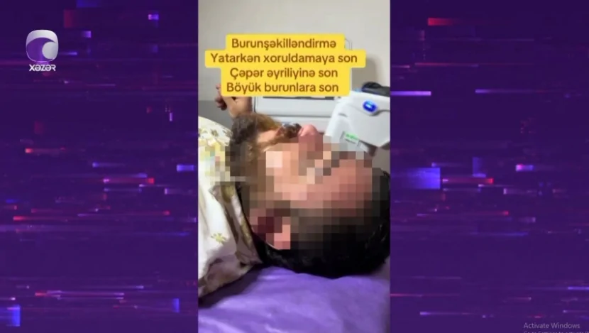 Aparatla \"burun kiçiltmə\" edənlərə XƏBƏRDARLIQ