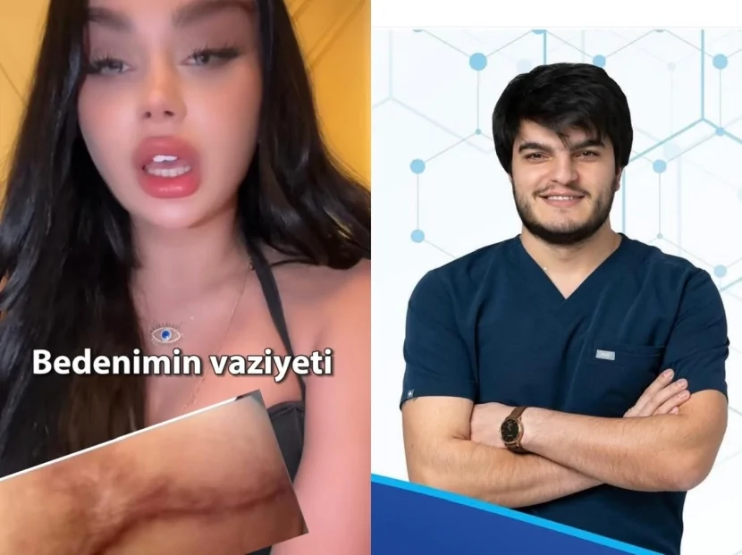 Müğənni estetik cərrahı ifşa etdi: Sertifikatsız həkimdən qalmaqal!