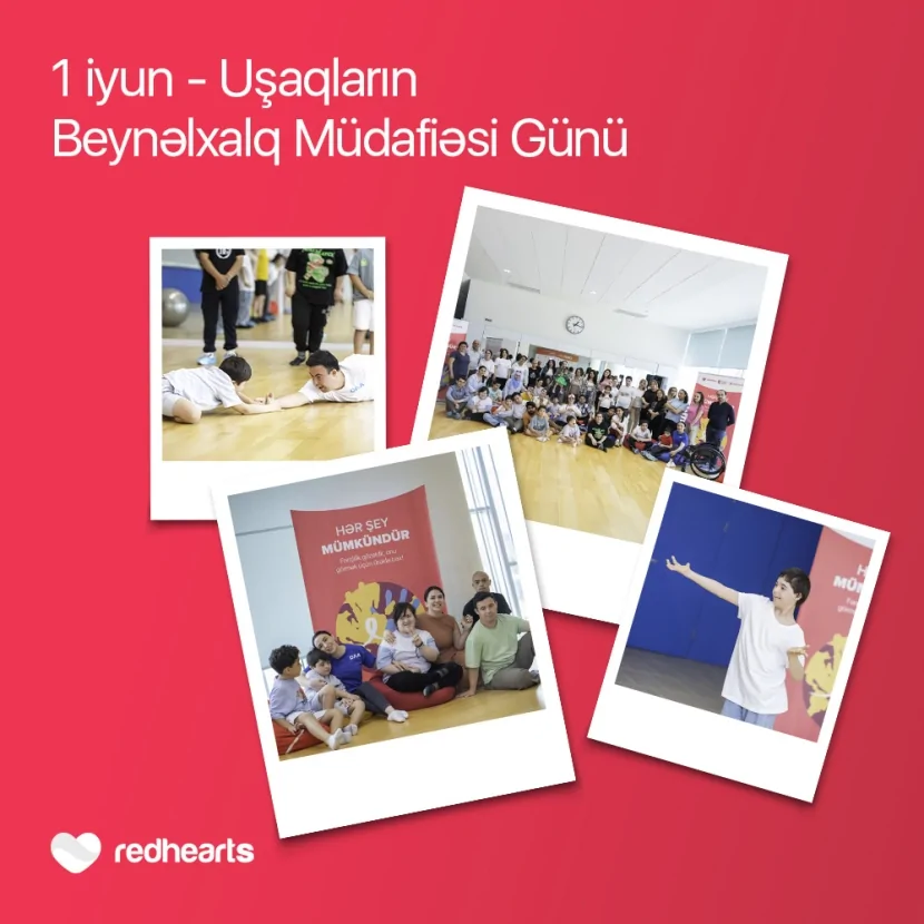 Hər şey mümkündür: Daun sindromlu uşaqlar üçün sosial layihə