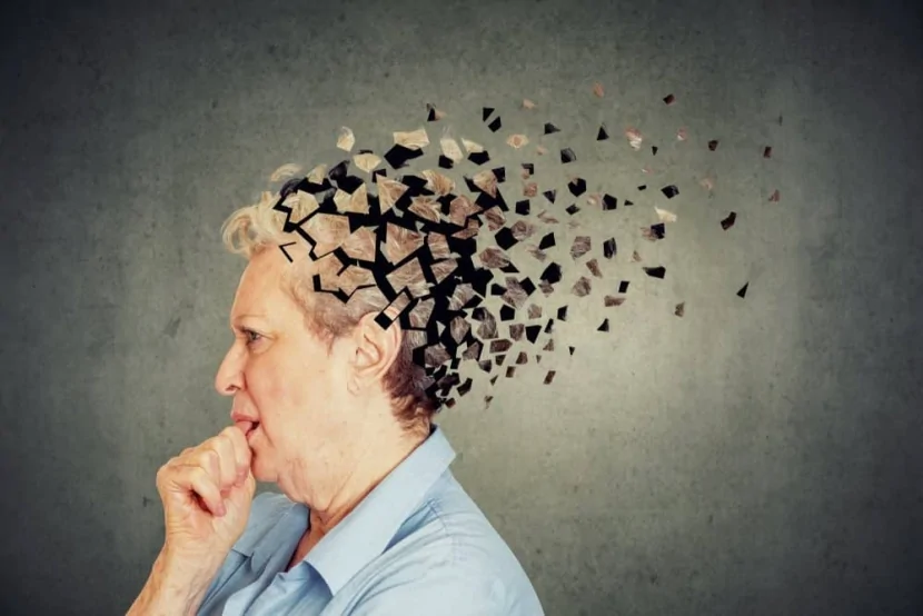 Alimlər Alzheimer xəstəliyi ilə mübarizə aparan “qoruyucu rejimi”ni aşkarlayıblar