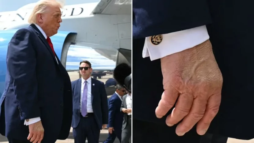 Trampın əlində yenidən göyərmə GÖRÜNÜ