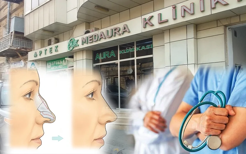 “MedAura” Klinikasının həkiminin yanlış əməliyyatı -